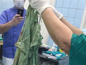 على الطريقة المصرية.أطباء روس يتركون قطعة قماش فى بطن سيدة حامل