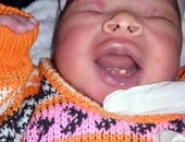 سيدة تضع مولوداً بـ 4 أسنان فى ولادة نادرة بمستشفى سوهاج التعليمى