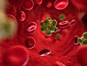 باحثون أمريكيون: فحص دم جديد يمكنه التنبؤ بعودة الإصابة بسرطان الحلق