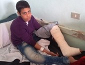 أب يتهم معلما بكسر ساق نجله أثناء امتحانات الإعدادية ببنى سويف
