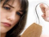 اضطراب الهرمونات والضغط النفسى أهم أسباب صلع النساء