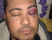 صحافة المواطن.. طبيب يعتدى بالضرب على فنى المعمل بمستشفى سيدى غازى بالبحيرة