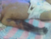 الإهمال الطبى يتسبب فى وفاة طفل بكفر الشيخ بعد بتر ذراعه