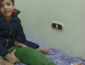 أسرة الطفل أدهم تطالب بعلاجه خارج مصر من مرض "الهيموفيليا"
