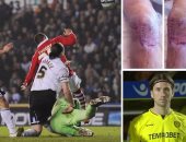 معجزات كرة القدم.. عودة لاعب إنجليزى بعد 4 مواسم ونصف من إصابة مرعبة 