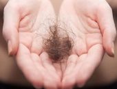 6 نصائح تقلل من مشكلة تساقط الشعر للمصابين بالغدة الدرقية