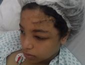 بالصور.. طفلة تصاب بنزيف فى المخ بعد سقوط مروحة فصل المدرسة على رأسها