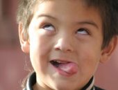 اختبار لغوى جديد يساعد فى التشخيص المبكر للأطفال المصابين بمتلازمة "توريت"