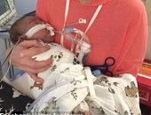 بالفيديو.. قلب طفل يظل ينبض بالحياة فى طبق المستشفى بعد استئصاله
