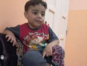 بالصور.. بعد إصابته بمرض نادر.. "أحمد" يأمل فى العلاج بالخارج