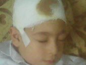 قارئ يشكو من " إهمال مدرسى" أدى إلى إصابة طفل بجروح فى رأسه بالقليوبية