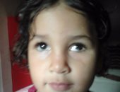 رويدا طفلة فقدت الرؤية بعينها اليسرى وتحتاج لعملية زرع عصب فى الخارج