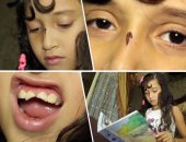 بالفيديو.. تلميذة تفقد أسنانها بسبب معلم في المطرية.. "خايفة أروح تاني"