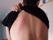 بالصور.. تفاصيل اعتداء مدير مدرسة فى بنها بالعصا على طالب لذهابه للحمام