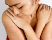 تعرف على أسباب وأعراض الأكزيما الجلدية.. أبرزها الطفح الجلدى والحكة