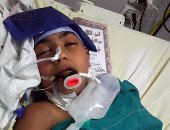 بسبب الإهمال..طفل يدخل مستشفى شبين الكوم بكسر ذراعه فيدخل فى غيبوبة 7 أيام