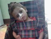 قارئ يستغيت بـ"صحافة مواطن" بعد إصابة ابنه بضمور بالمخ فى كفر الشيخ