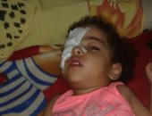الطفلة "ريتال" مصابة بضمور بالمخ.. ووالدتها تناشد وزير الصحة لعلاجها