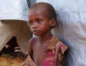 دراسة أمريكية: فقر الدم يحمى الأطفال من الملاريا بأفريقيا