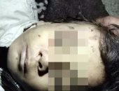 تحقيقات مصرع طفل بالبدرشين :طلقة طائشة من فرد خرطوش هشمت رأسه