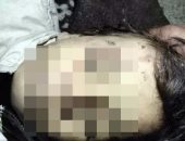 العثور على جثة مجهولة لطفلة بها آثار تعذيب فى الإسكندرية
