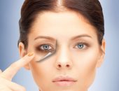 تخلصى من الهالات السوداء باستخدام البطاطس والشاى والحليب