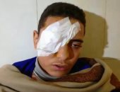 بالفيديو والصور.. تفاصيل اعتداء طالب على زميله وفقء عينه بـ"قلم" فى سوهاج
