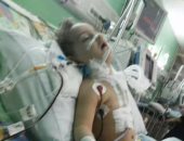 مأساة بسملة.. خطأ طبى يشوه صدر الطفلة والمستشفى ترفض استكمال علاجها