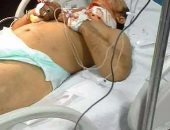 صحة المنوفية تورد دم وبلازما لسائق التوك توك المصاب بمستشفى شبين الكوم