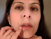 4 نصائح للتخلص من اسمرار الجلد حول الفم..قللى التدخين ورطبى المنطقة