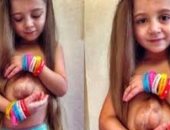 بالفيديو.. "فيرسيفيا" طفلة بقلب خارج القفص الصدرى (تحديث)