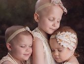 أصيبت شقيقتهما بالسرطان فحلقن شعرهن للتضامن معها.. تعرف على القصة