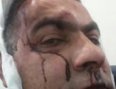 إسرائيليان يعتديان بالضرب المبرح على سائق من عرب 1948 ويصيبانه بجراح