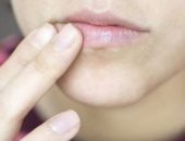 7 أشياء تجنبها إذا كنت مصابا بجفاف الفم 