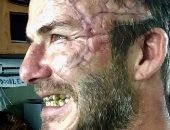 بالصور.. تعرف على سبب تشوه وجه ديفيد بيكهام