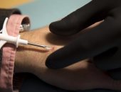 شركات سويدية تستبدل بطاقات هوية الموظفين بزرع شرائح إلكترونية داخل أجسامهم