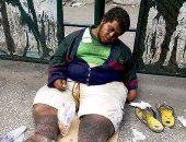 محمد شاب مصاب بعدة أمراض ويعيش فى الشارع بدون رعاية