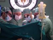 استئصال جزء من الكبد بإستخدام أدوات جراحية جديدة بالمؤتمر الدولى بالمنوفية