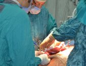 فريق طبى بمعهد جنوب مصر للأورام يستأصل ورم سرطانى
