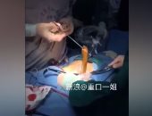 بالفيديو.. استخراج ثعبان حى من معدة رجل صينى