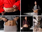 سيدات صينيات يستخدمن التاتو لإخفاء آثار الولادة القيصرية