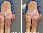 العثور على جثة طفلة مجهولة بها آثار تعذيب فى مرسى مطروح