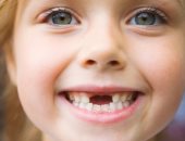 8 أسباب وراء رائحة الفم الكريهة عند الأطفال.. تعرف عليها