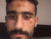 باسم مرسى ينشر أول صورة بعد نجاته من حادث بأكتوبر..ويؤكد: أنا كويس الحمدلله