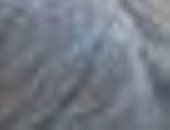 النيابة تباشر التحقيق فى تآكل جدران بطن الطفل يوسف بسبب إهمال طبى بالشرقية