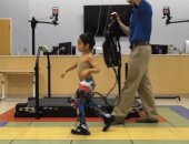 علماء يطورون أطراف روبوتية تساعد الأطفال مرضى الشلل الدماغى