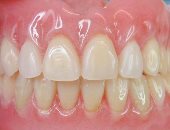 مشاكل الأسنان الشائعة وطرق علاجها