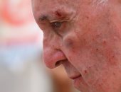 صور إصابة البابا فرنسيس بجرح وكدمة بعينه اليسرى خلال زيارته بكولومبيا