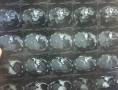 قارئ يطالب بإجراء عملية جراحية لأخته على نفقة الدولة بمعهد الكبد القومى بشبين الكوم