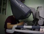 بالصور.. روبوتات الجراحة فى الصين تجرى 40 ألف عملية ناجحة